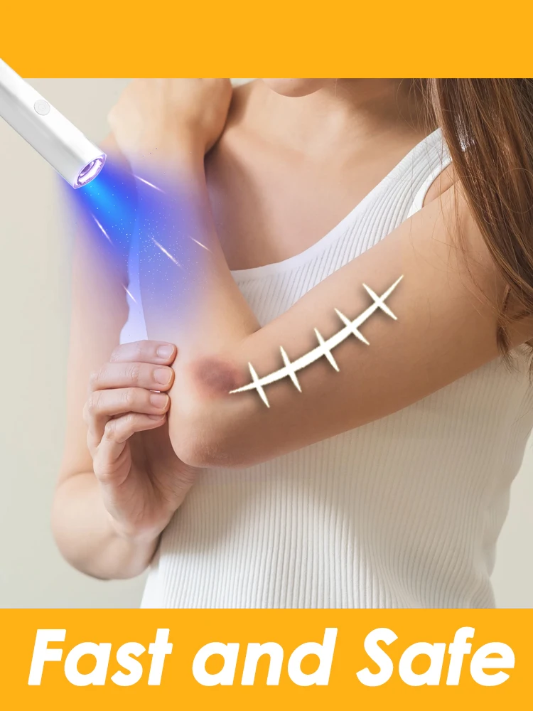 

крем для шрамов, лазерная ручка, 30 г, китайская травяная эссенция。