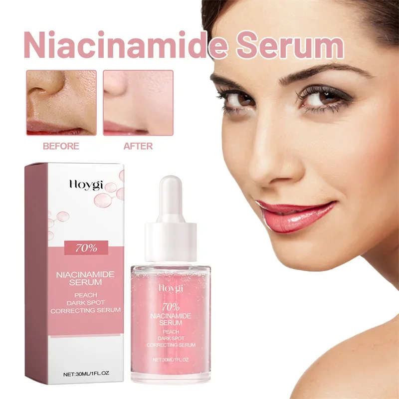 

Niacinamide Whitening Facial Essence Remove Acne Marks Dark Spots Moisturizing Repair Shrink Pores Brighten Face Skin Care Serum