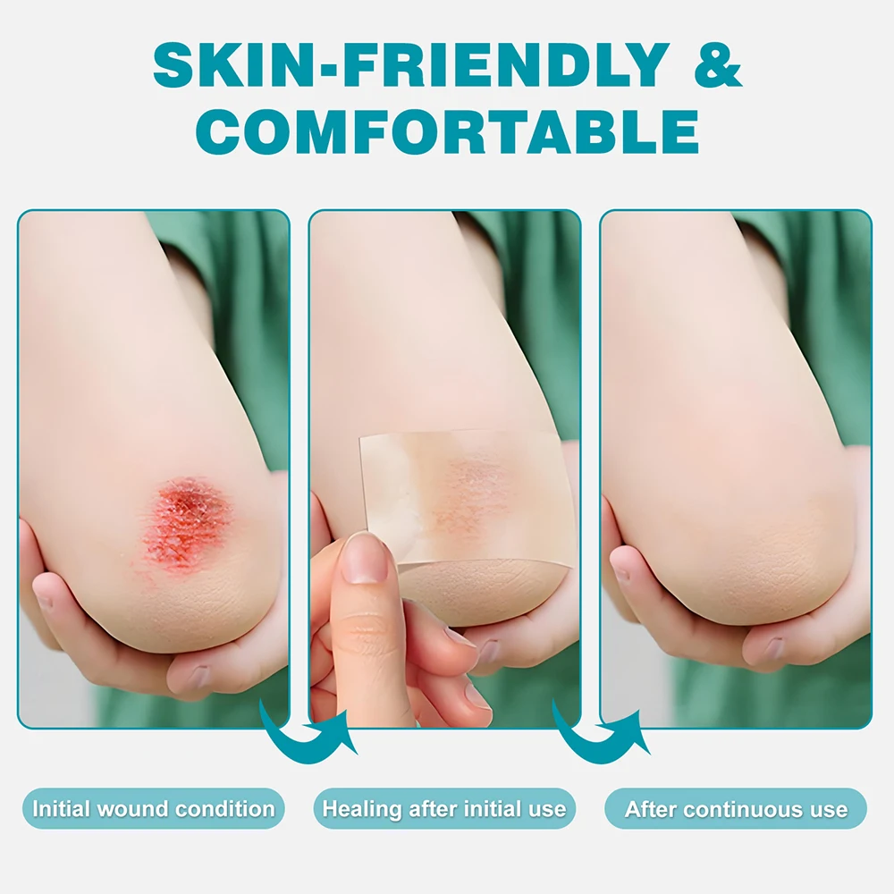 Hydrocolloid Roll Self-Adhesive Hydrocolloid Patch Bandage For Wound Care Bed Sore Bandages Hydrocolloid Gel Waterproof Patches view 4