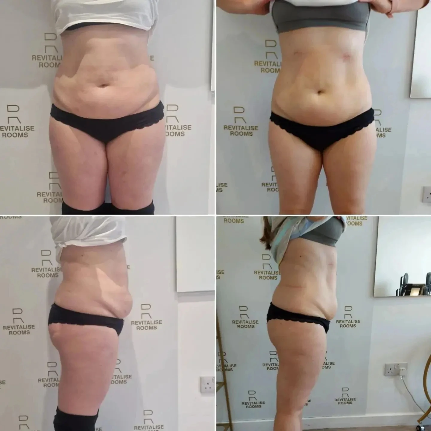 Profesjonalna maszyna RF Emszero NEO 2024 EM Body Slim Stymulacja mięśni EMSZERO PRO Ultra Sculpt Therapy EMS+EMT/RF Schudnij