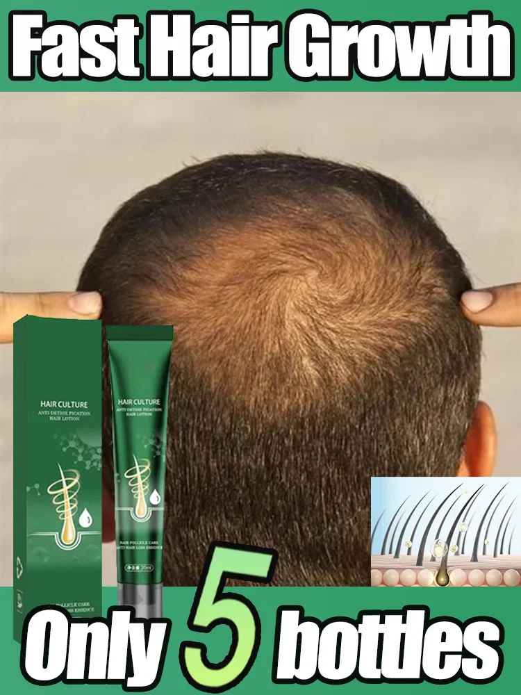 Fast Hair Growth Oil Baldness Repair Hereditary Hair Loss Postpartum HHair Loss Seborrheic Hair Loss Oil Fast