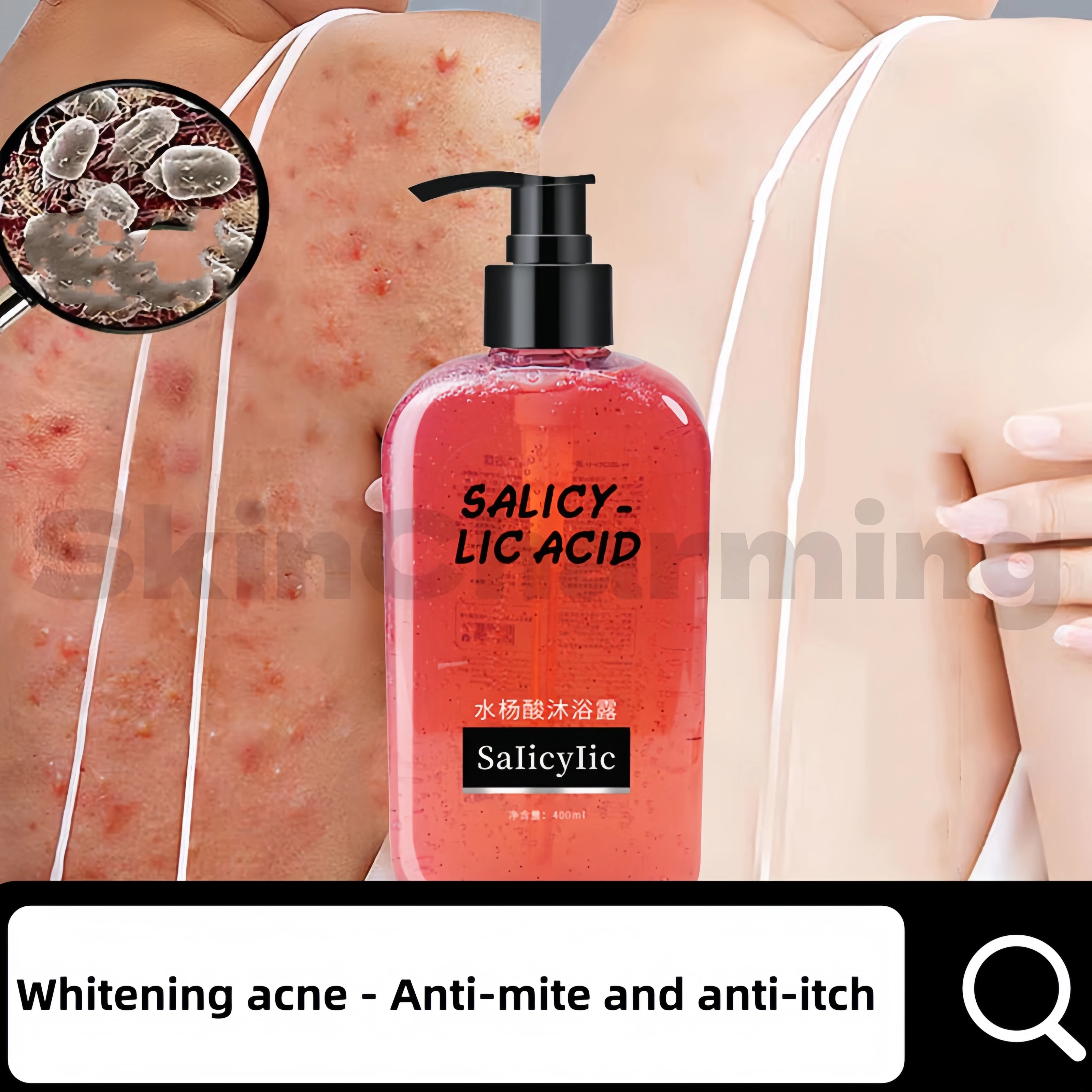 

Salicylic acid shower gel back refreshing oil control acne-removing chicken skin exfoliating long-lasting fragrance shower gel