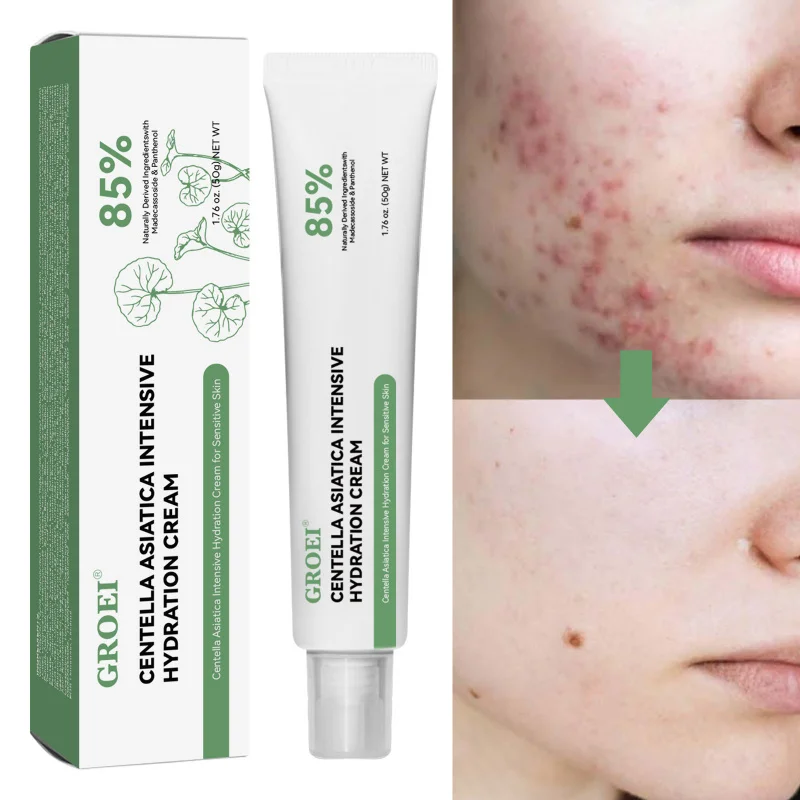 

Exfoliating Moisturizing Serum Hydrating Solution Removes Dull Cells, Replenishes Moisture and Softens Stubborn Dry Skin