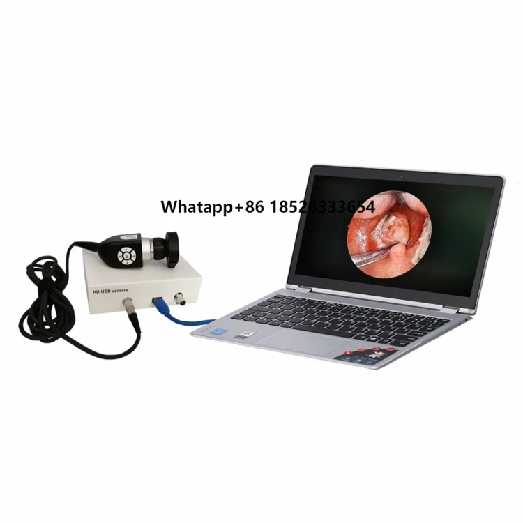 Handheld ENT Endoscope With Real-Time Imaging Ideal For Examining Nasal Cavities Light Weight , Easy To Use In Clinical Settings