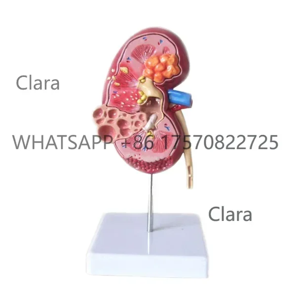 Clara Tools StorePlastic Kidney Anatomical Model, Human Kidney ModelClara Tools Store