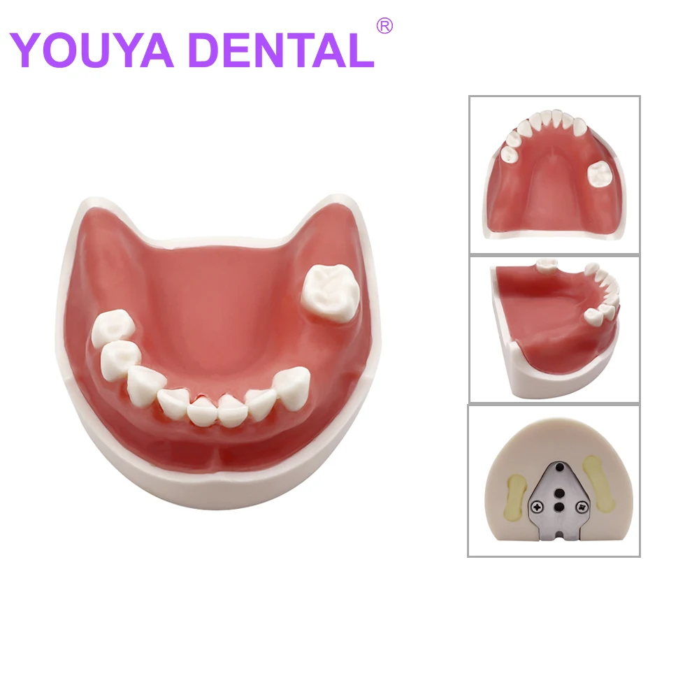 Dental Teeth Model Training Jaw Implant Practice Demo Typodont Soft Gum Model Dentistry Teaching Practice Demonstration Tools