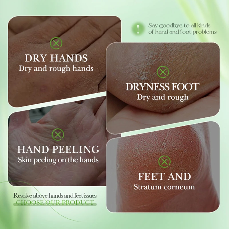 Thumbnail 3 - #11 Trending Hand Care Right Now
