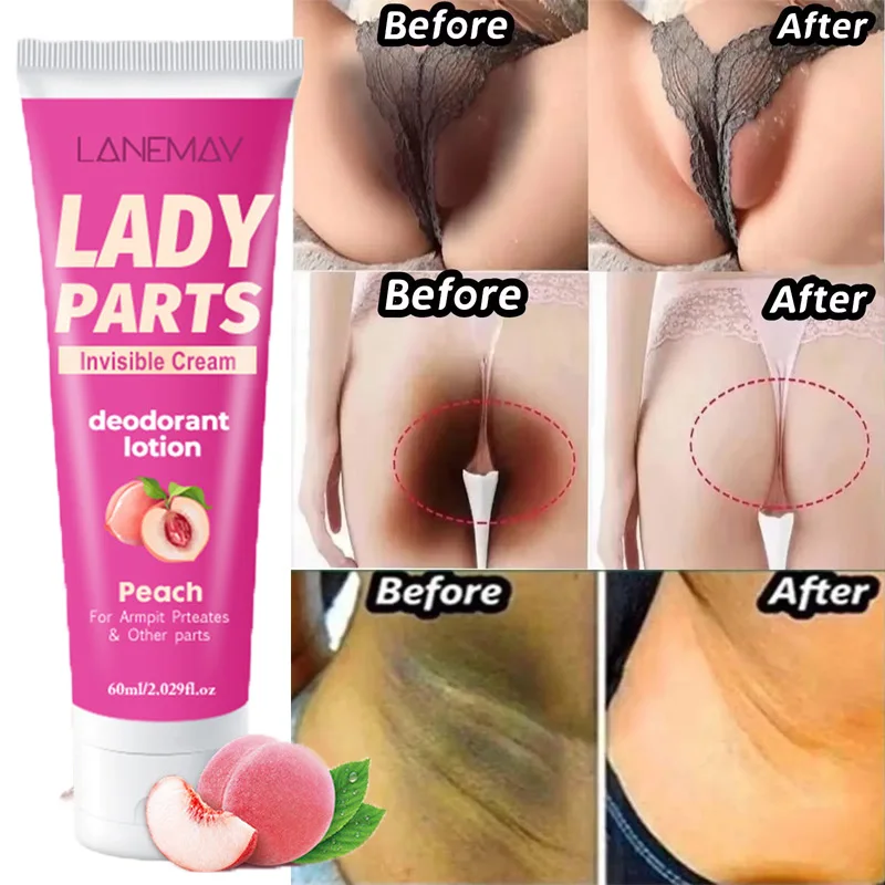 

Peach Body Whitening Cream Private Parts Underarm Legs Knee Bleach Brighten Lotion Lighten Thigh Inner Remove Melanin Skin Care