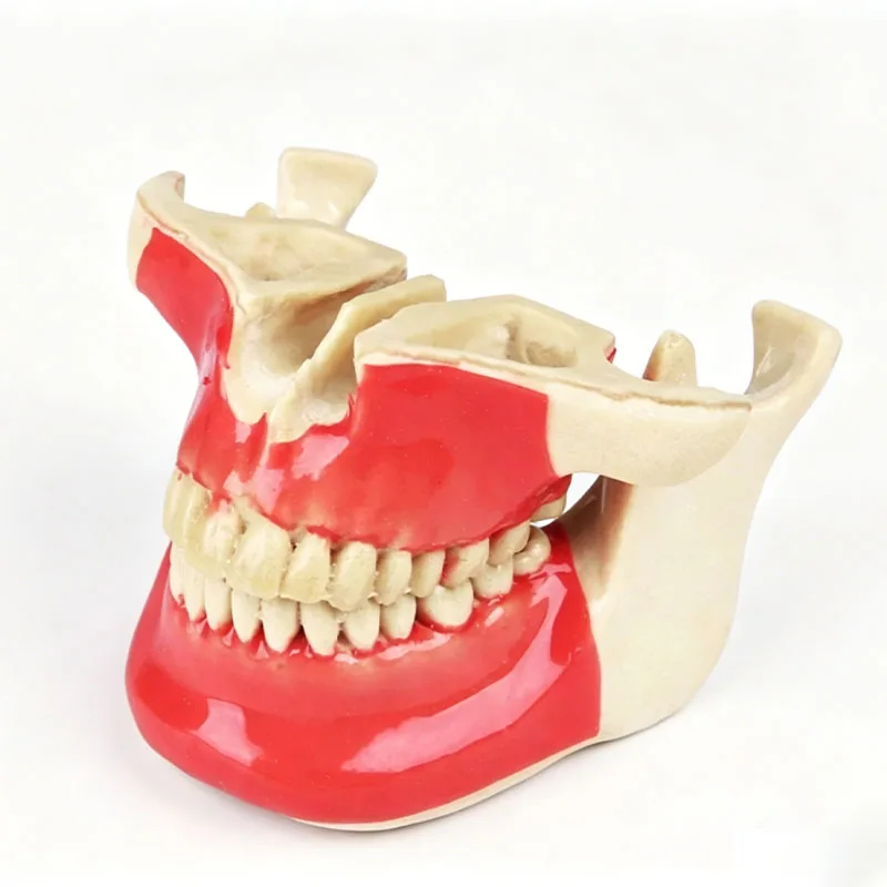 

Orthodontic Implant Dental Model Removable Anchorage Nail Practice Model Student Experiment Teaching Training Model