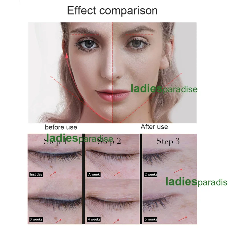 Anti-Aging mikroprądowy stymulator urody jonowej lifting twarzy odmładzania do ujędrniania skóry usunąć zmarszczki galwaniczne masażer