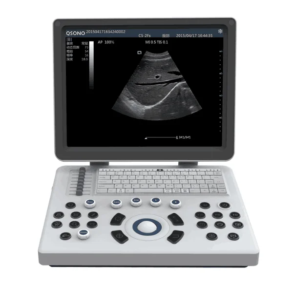 HEDY 15 inch TFT display laptop scanner portable ultrasound price for vet