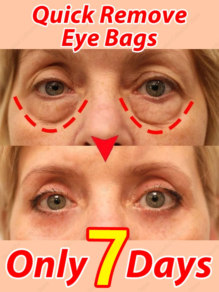 

Solve all the eye problems