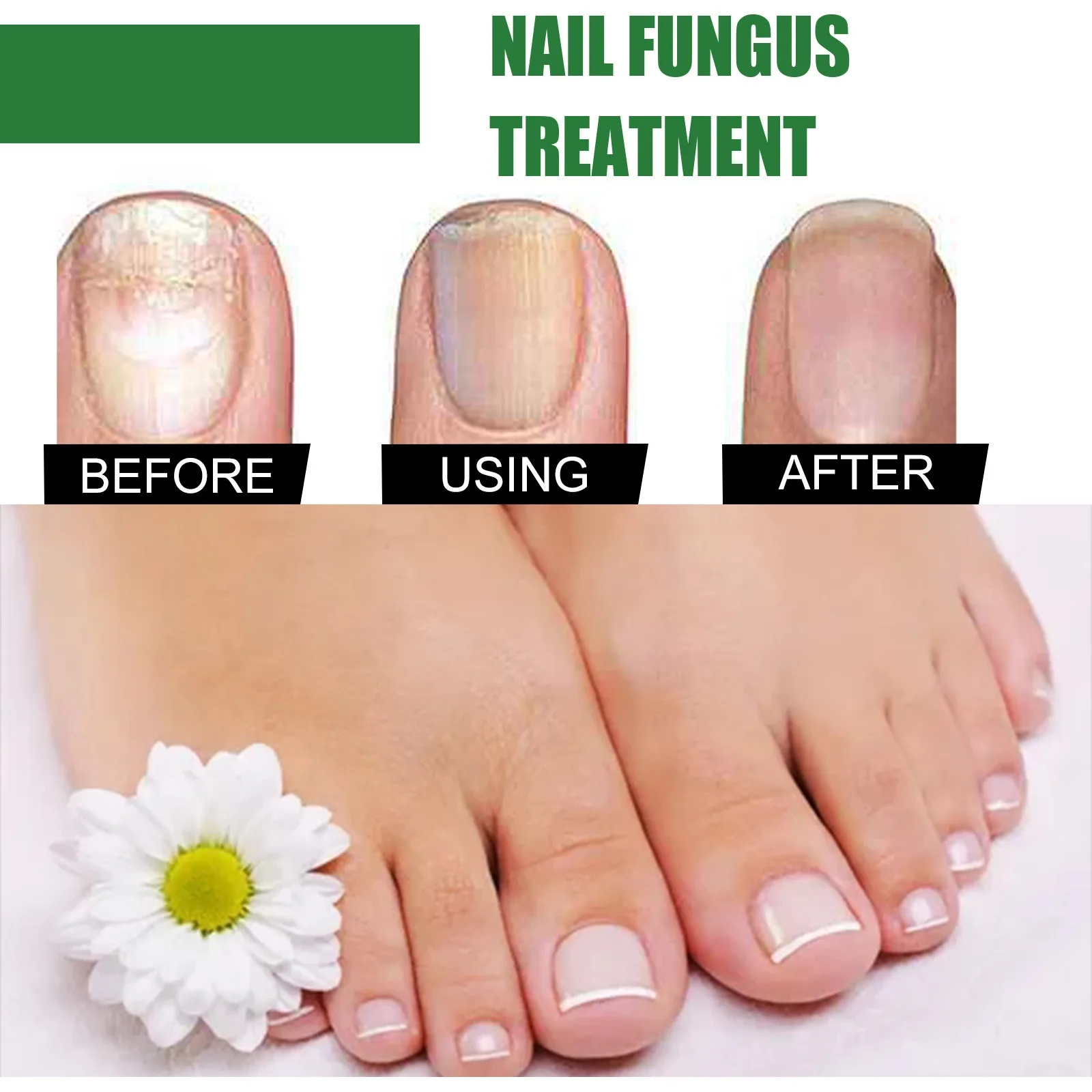 Intense Nail Growth And Strengthening Serum 7 Days Nail Growth And Strengthening Serum Nail Strengthener For Thin Nails