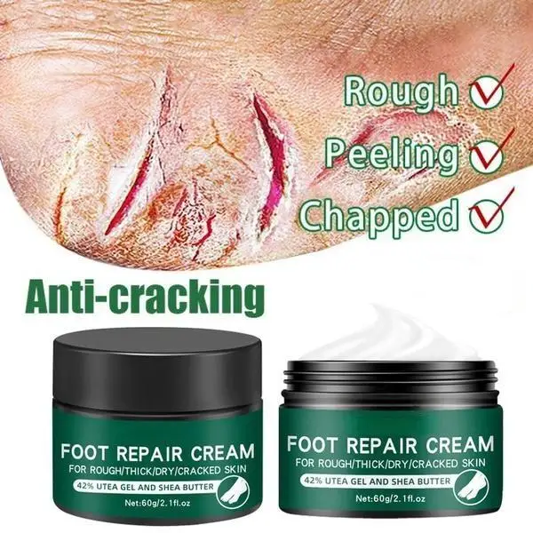 Newest Hand and Foot Skin Repairing Moisturizer Cream Anti-Chapping for Rough Dry and Cracked Chapped Feet Heel Repair Foot