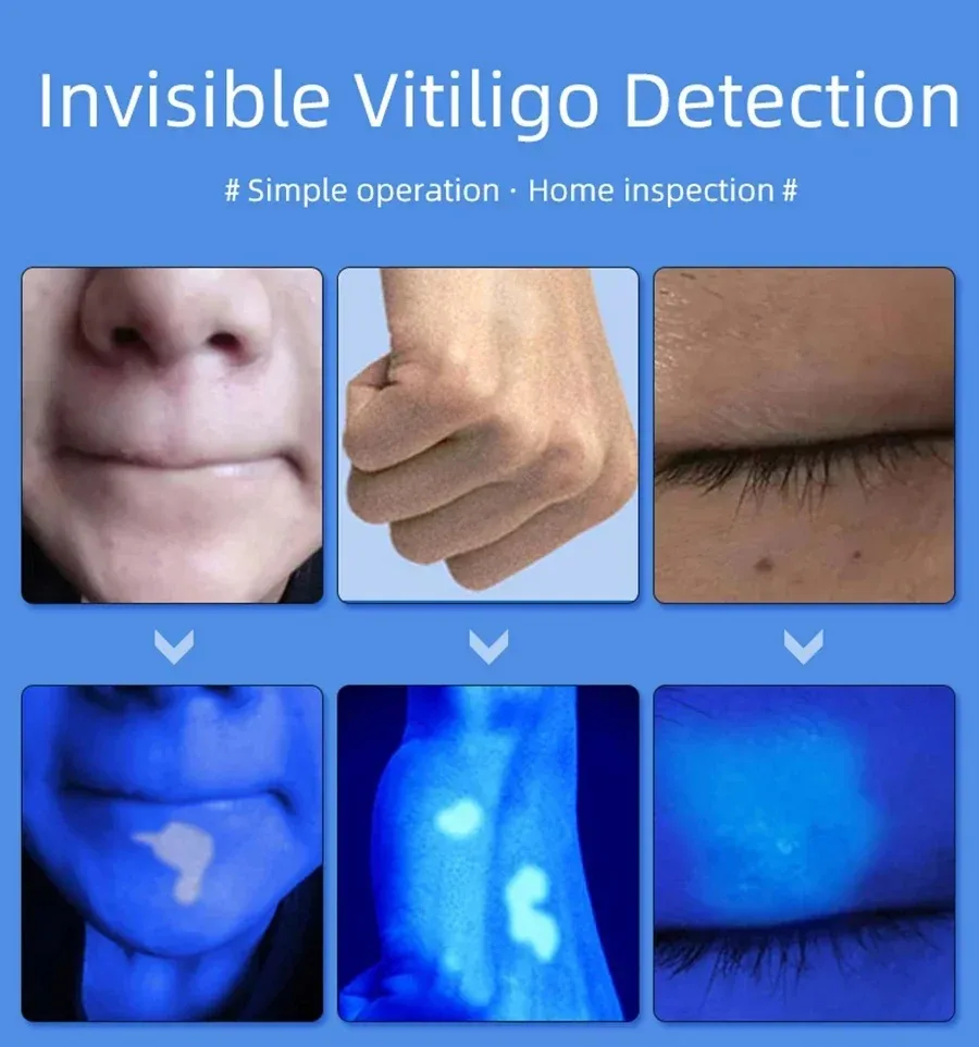 NUOVO Analizzatore della pelle della lampada Woods per la pelle Lente d'ingrandimento UV per test del viso di bellezza Lampada in legno Rilevamento dell'analisi della pelle leggera Cura della pelle