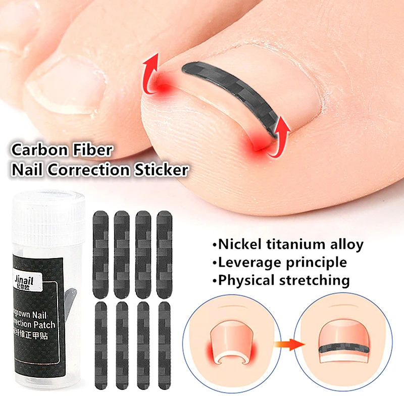 10Pcs Ingrown Toenail Correction Tool Straightening Clip Brace Toe Nail  Elastic Patch Sticker Pedicure Care Tool