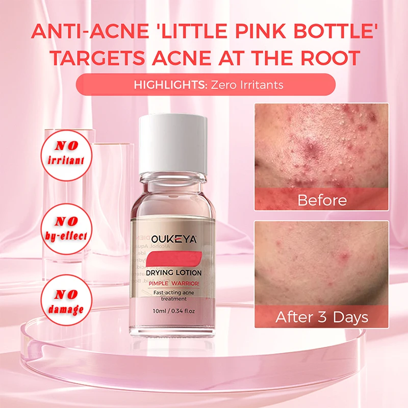 

Anti-Acne Facial Repair Whitening Essence Shrinks Pores Moisturizes Controls Oil Removes Blackheads & Acne Deep Cleaning Pore