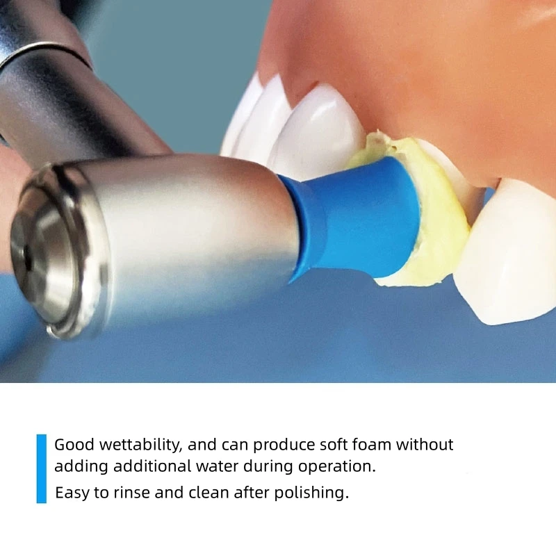 40g/tuba pasta do polerowania zębów dentystycznych regularna drobnoziarnista pasta profilaktyczna Ortho Implant Prophy Paste materiały do ​​wybielania zębów