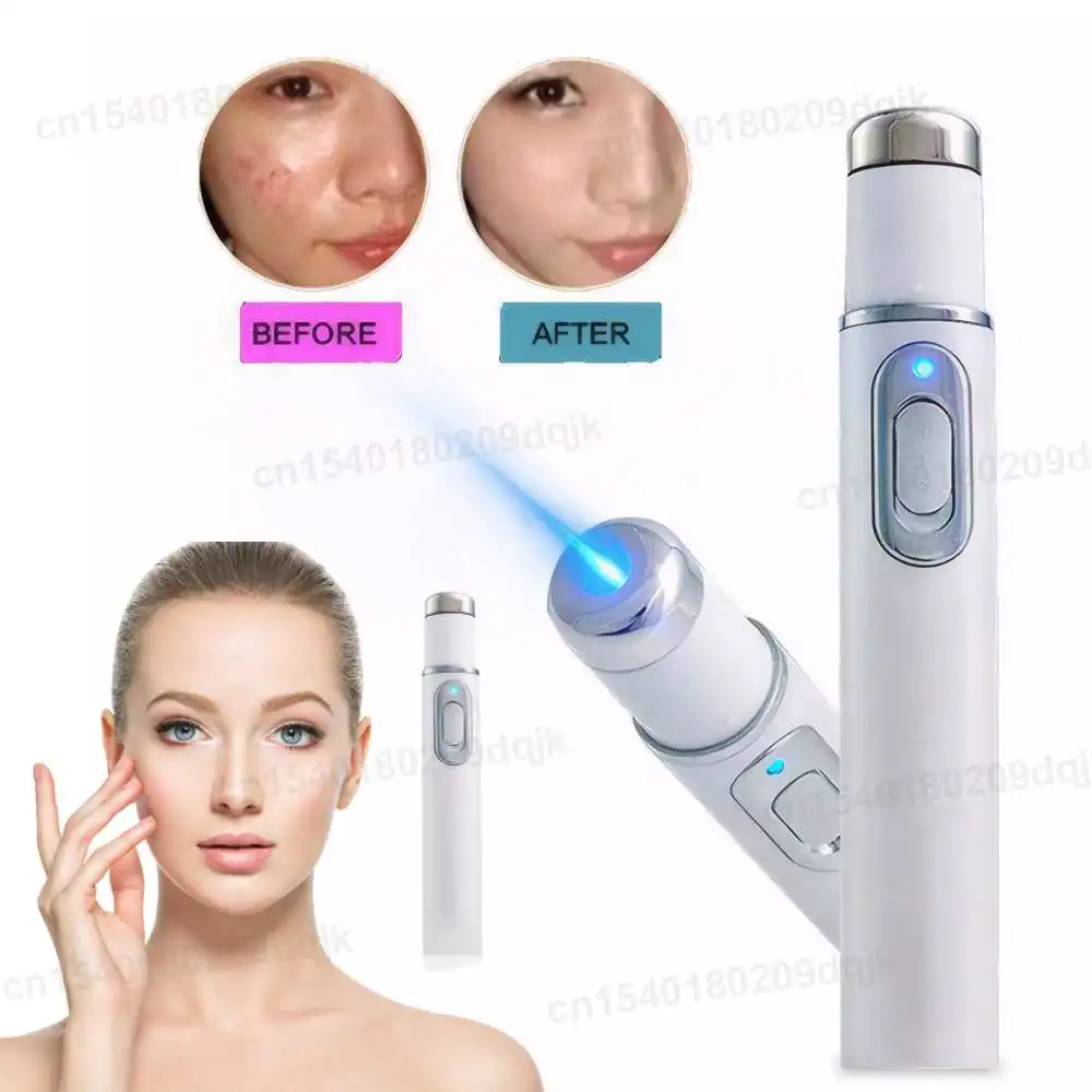 Blue Light Therapy Acne Pen LED Face Light Therapy For Scar Wrinkle Removal Treatment Device Skin Care Beauty Equipment
