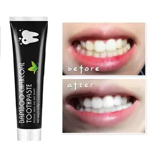 8 최고의 판매 치아 연마 페이스트 - №5