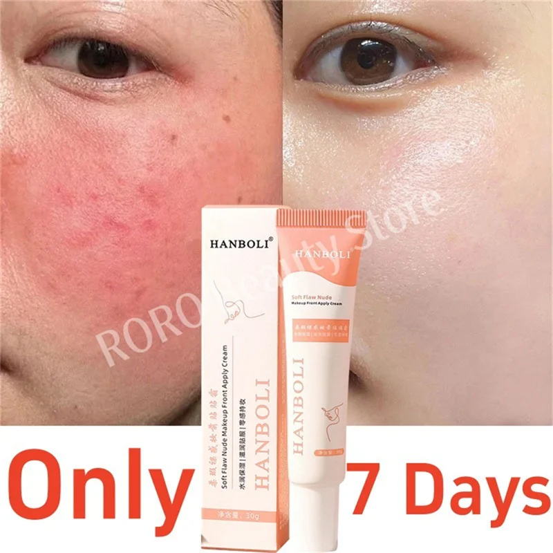 

7 Day Repair Facial Redness Cream Soothing Redness Repair Skin Rosacea Red Blood Improve Sensitive Skin CareKorean Cosmetic