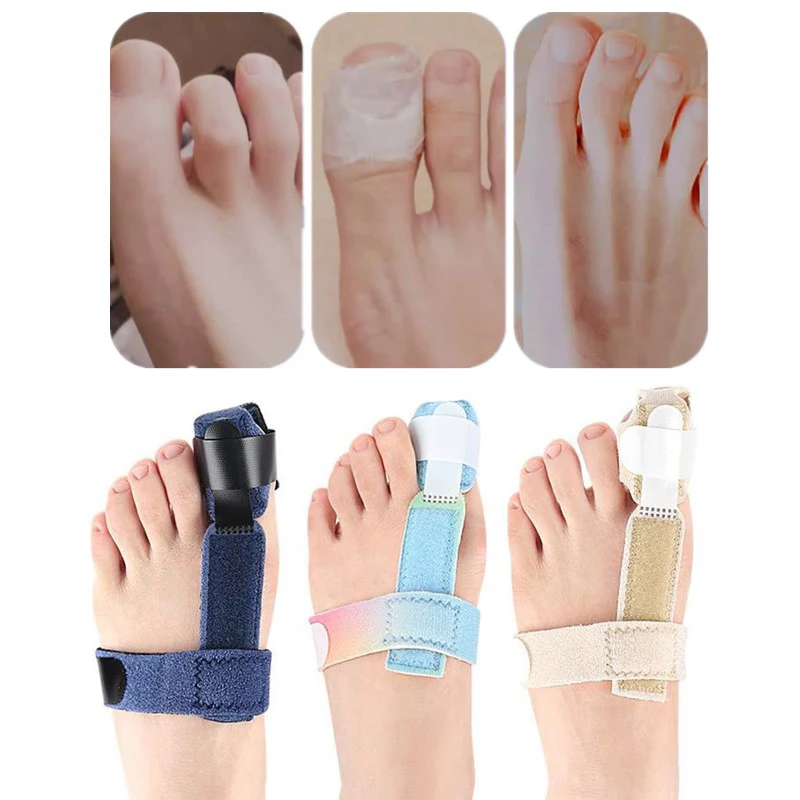 발 스트랩 발가락 교정기 발가락 골절 고정 장치 교정기 발 뼈 엄지 조절기 CorrectionSoftPedicure 양말 Bunion Straightener
