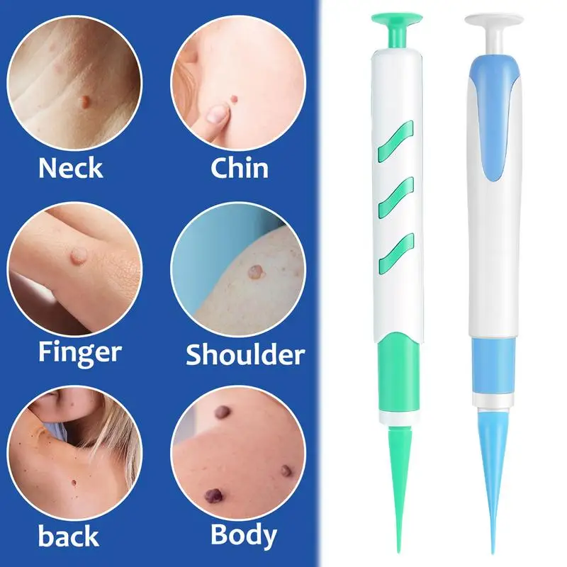 Skin Tags Remover Auto Skin Tags Removal Kit Wart Removal With 30 Small And Large Skin Tags Bands For 1-4mm Groins Small Warts