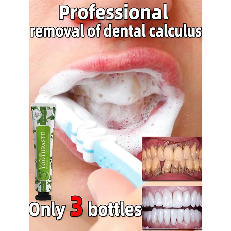 

Toothpaste Removal Dental Calculus Whitening Teeth Fresh Breath Mouth Odor Preventing Periodontitis Decrease Plaque New 2024