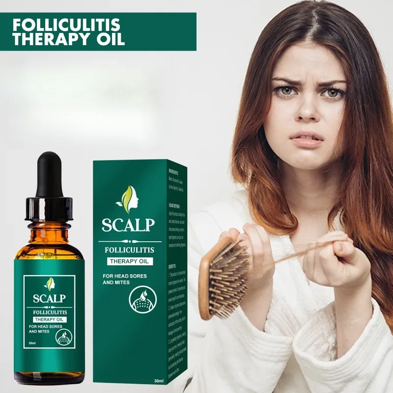 Aceite esencial para el crecimiento rápido del cabello para hombres y mujeres, productos para el crecimiento del cabello de jengibre, suero para prevenir el adelgazamiento, reparación del encrespado seco, refrescante