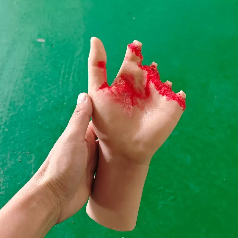 Silicone Trauma Hand Model, Simulated Amputated Palm Prop, Laceration & Battle Wound Simulator for Medical Education Training