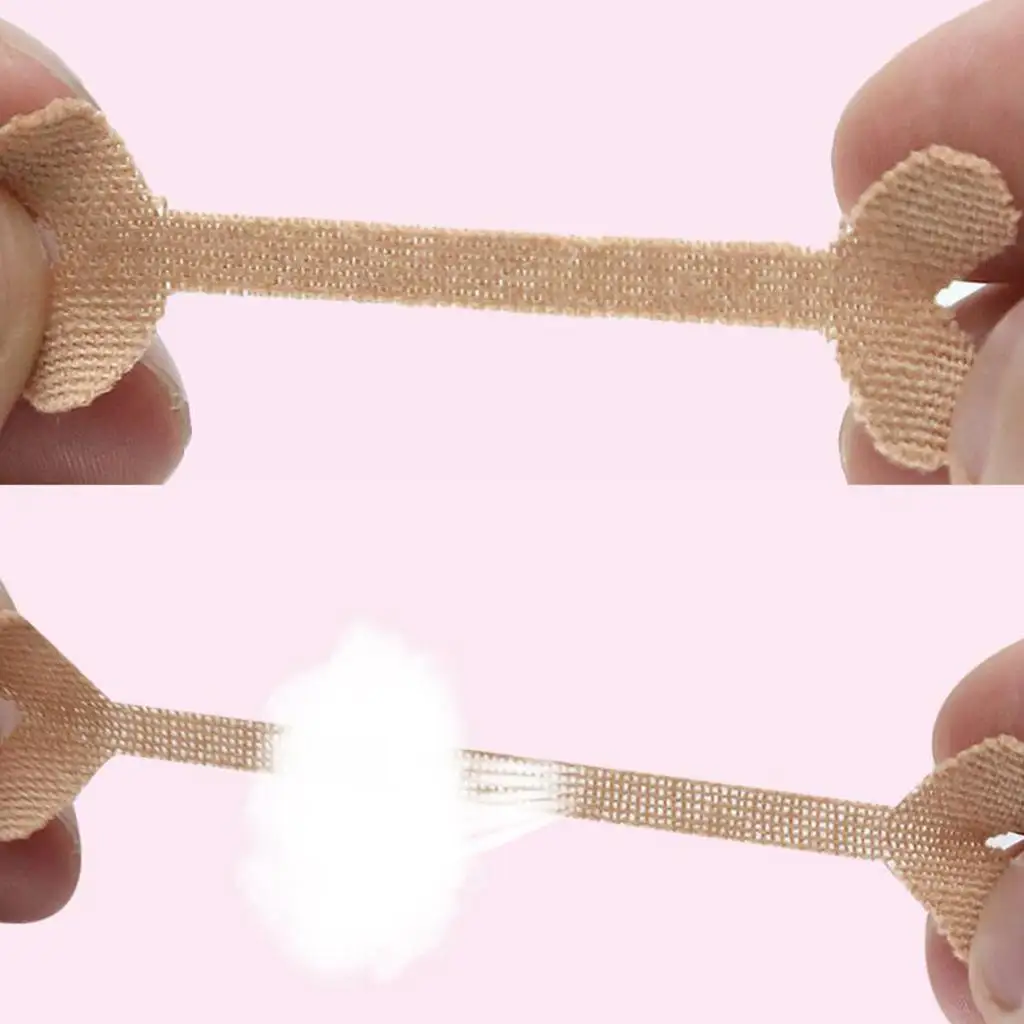 1 kit de adesivos de correção de unhas encravadas para adultos,