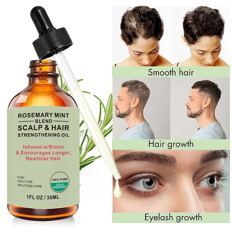 30ml Natural Hair Growth Lotion Rapid Hair Growth Rosemary Mint Blend Scalp Hair Strengthening Oil Hair Care Grow Hair 2024 New