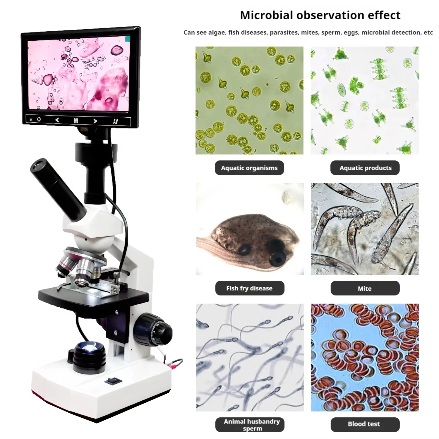 مجهر رقمي بشاشة عالية الدقة الأكثر مبيعًا مناظير بيولوجي 400x مجهر بيولوجي مختبر طبي بيولوجي