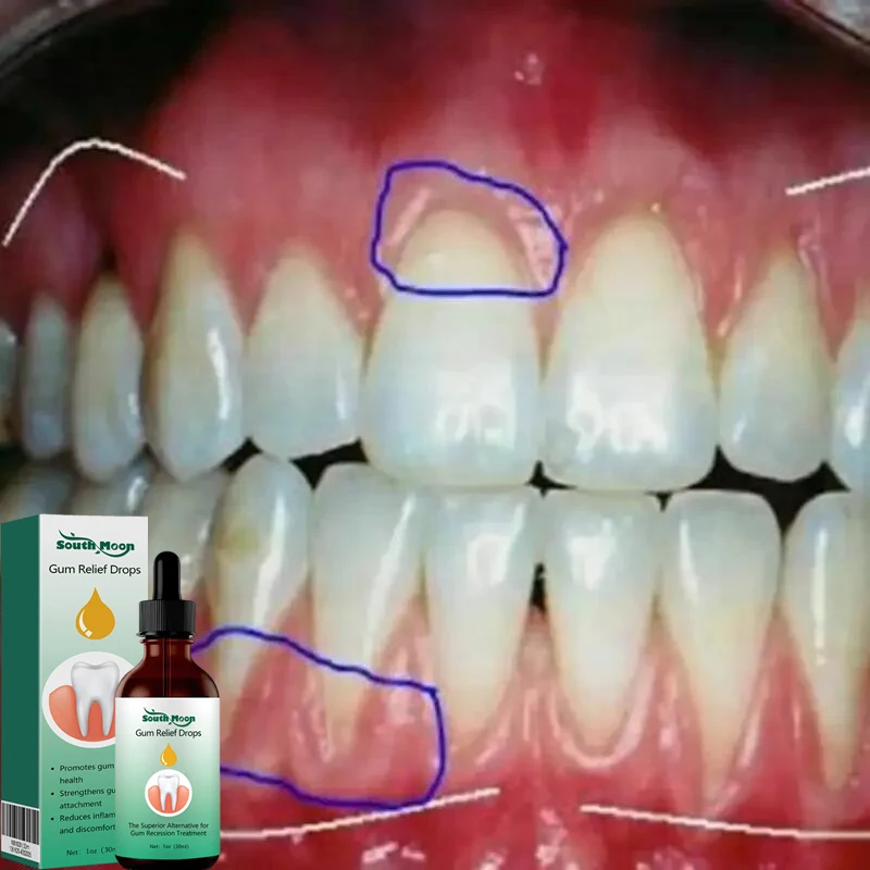 

Quickly Gum Repair Serum Drops Relieve Receding Gum Periodontal Blistering Care Teeth Whiten Remove Yellow Toothache Toothpaste