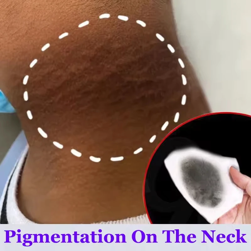 كريم تبييض الأجزاء الخاصة تحت الإبط مصل تبييض تبييض بعقب الركبة سطع الفخذ الداخلي الأجزاء الحميمة إزالة الميلانين الداكن #6