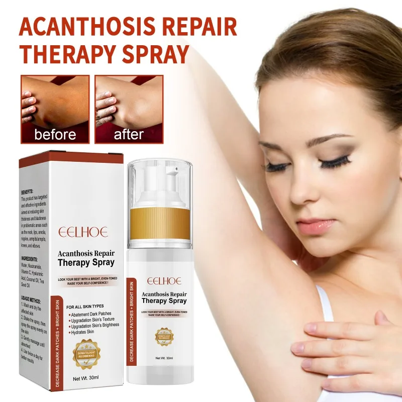 Acanthosis Nigricans Therapy Spray Remove Dark Melanin Armpit Elbow Knee Joint Whitening Clean Cuticle Peeling Body Remover