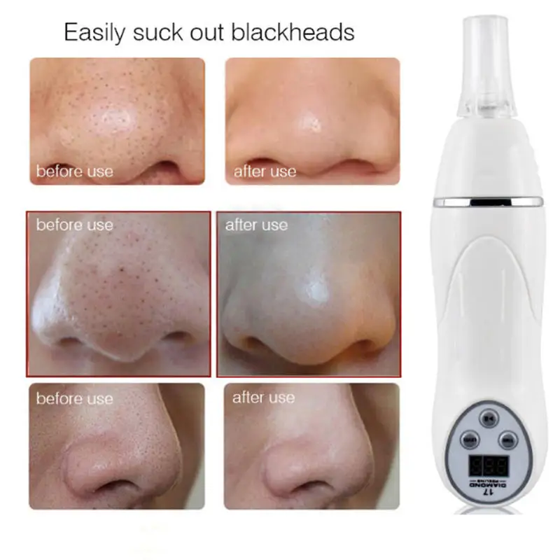 اللوازم الطبية الماس جلدي آلة إزالة الرؤوس السوداء البثرة إزالة الرؤوس السوداء حب الشباب فراغ تدليك العناية بالبشرة جهاز الجمال #3