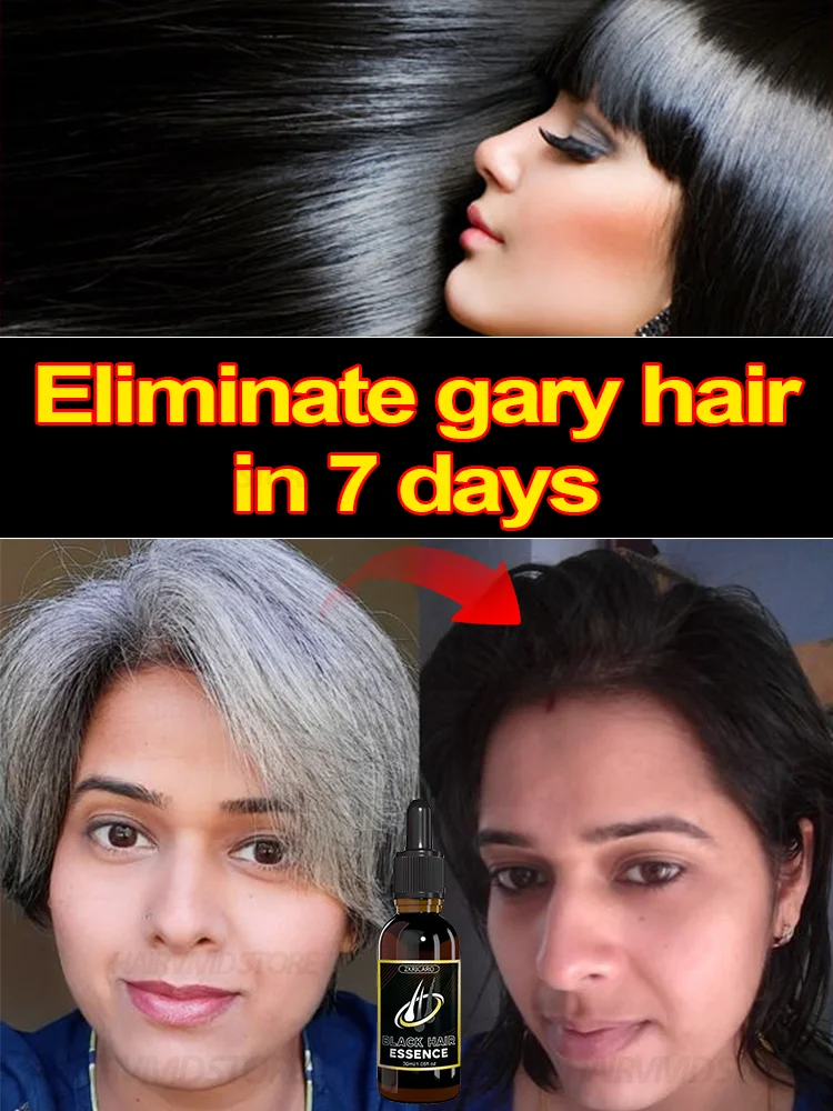 

gray hair remedyr;Natural Color/ anti gray hair & Darkening Hair | Nourishing HAIR Care /Restore natural color