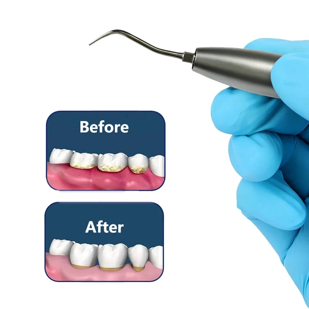 Dental Air Scaler Handpiece Activation Irrigation Root Canal Irrigator Fit KaVo Coupler Ultrasonic Scaler Calculus Removing
