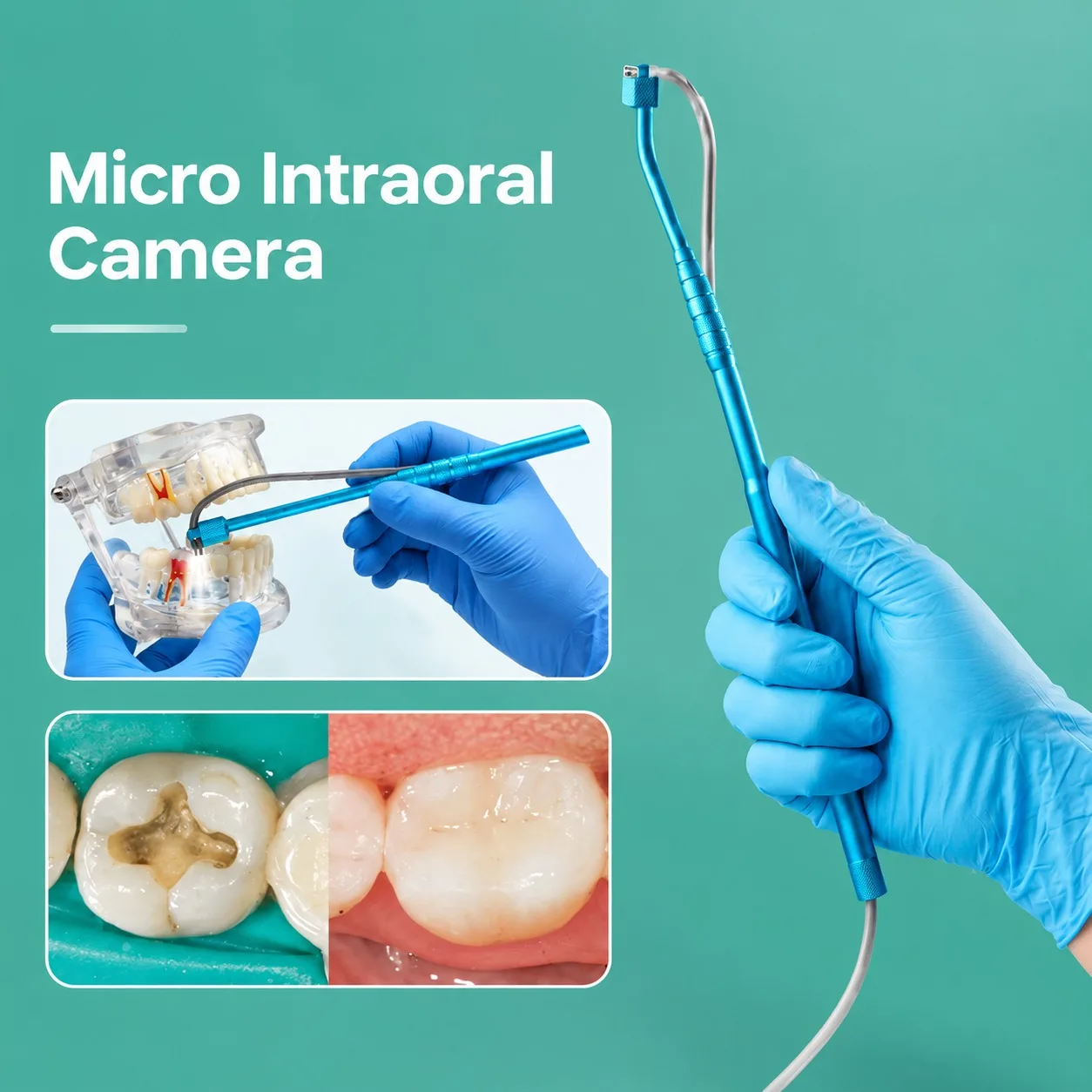 CE Dental Intraoral Camera LED Micro USB Tooth Inspection Camera Root Canal Treatment Camera with Software for Dentist WindowsPC