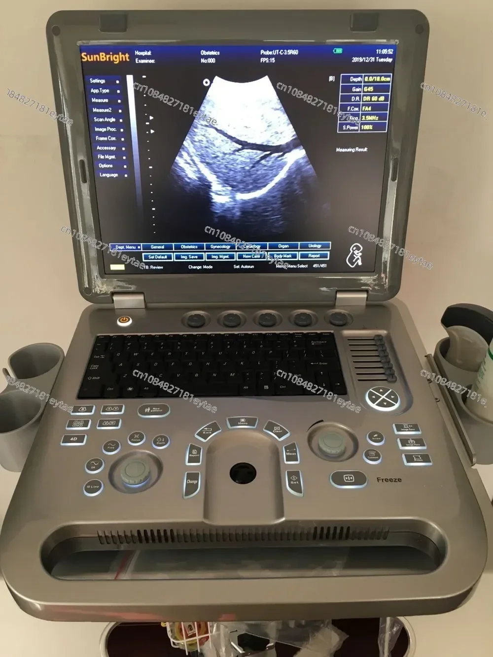 digital portable 3D ultrasound machine with echograph ultrasound system and echocardiography price