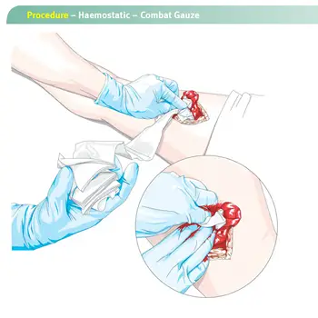 Garza emostatica di caolino, solubile in caso di emergenza, per traumi, piegata a Z, per kit di pronto soccorso militare tattico Ifak, medicazione medica per ferite 10 best sales garza emostatica - №5