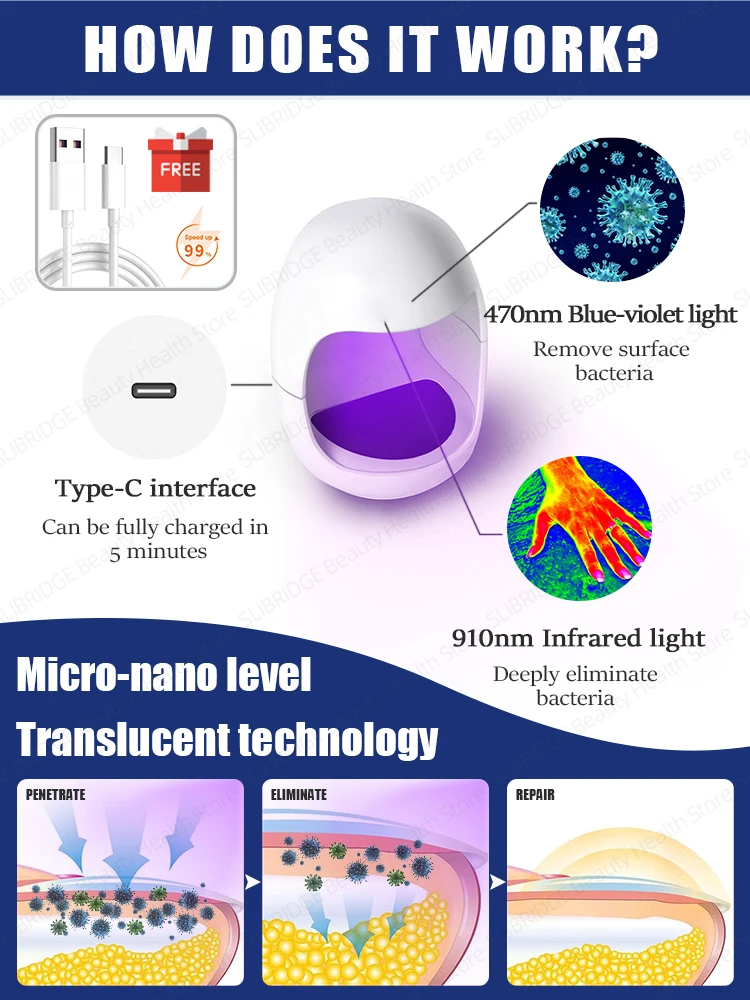 ERASE Onicomicosis FOREVER! Recurrencia ZERO NO daños en las uñas: ¡MATAR los hongos en 7 días, 99,3% tasa de SUCCESS!