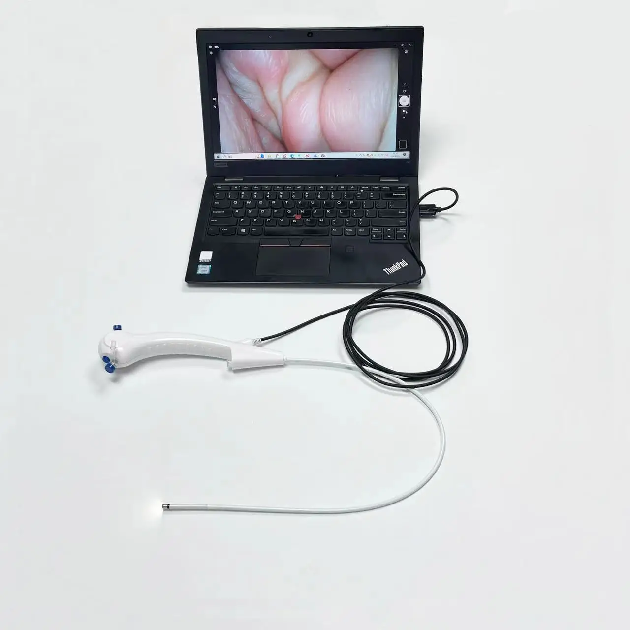 Sensorendo single use flexible video laryngoscope/rhinolaryngoscope with USB cable Mega pixel lens for intubation/ENT