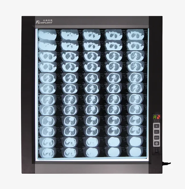 Profession elle wirtschaft liche Krankenhaus Bagihrte Röntgen Röntgen Visionneuse de film Negatos kop Röntgen HFZG-D