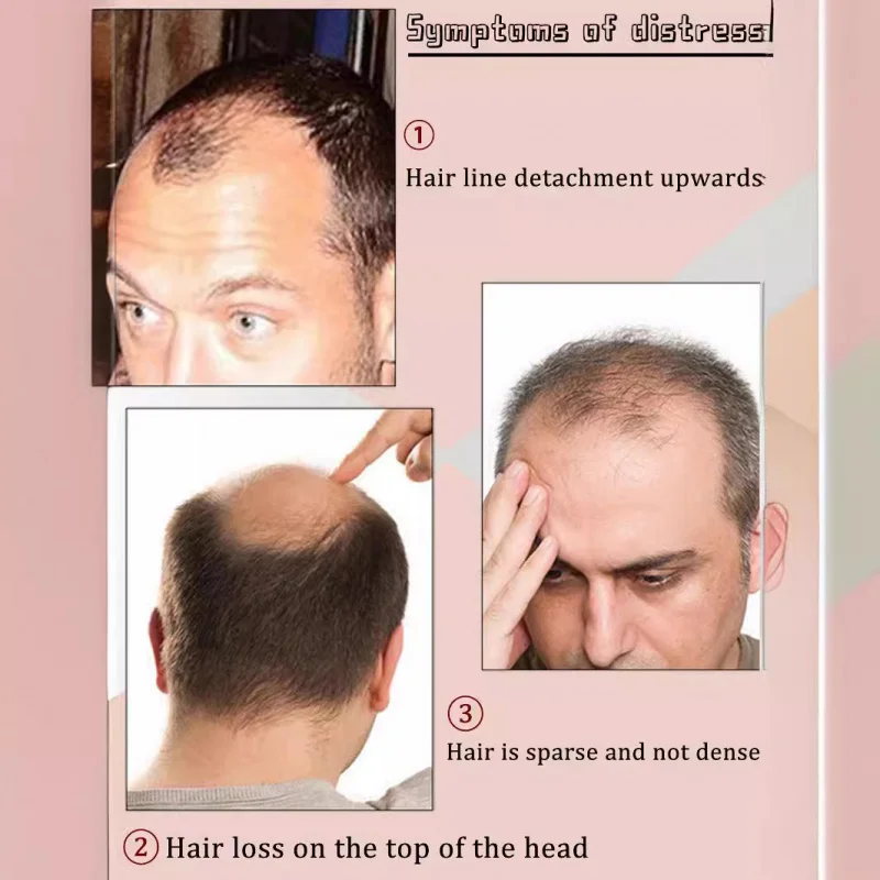 Wig sintetis lurus dan bergelombang bernapas tanpa bekas tembus pandang alami pria prostesis rambut tahan lama untuk pria