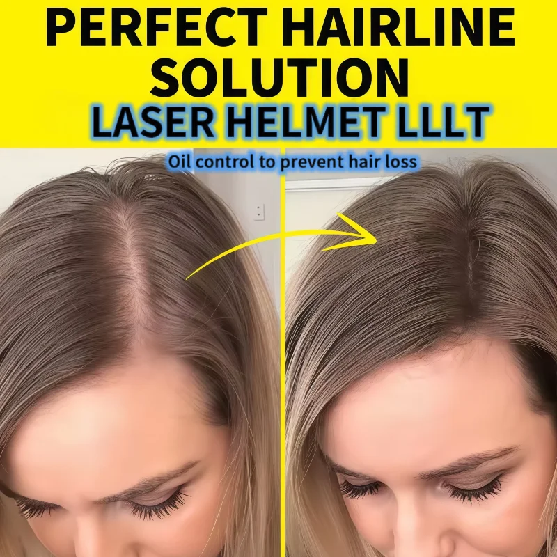 

Эффективная лазерная шапочка для роста волос 650 нм, низкочастотная LLLT для лечения хронического выпадения волос