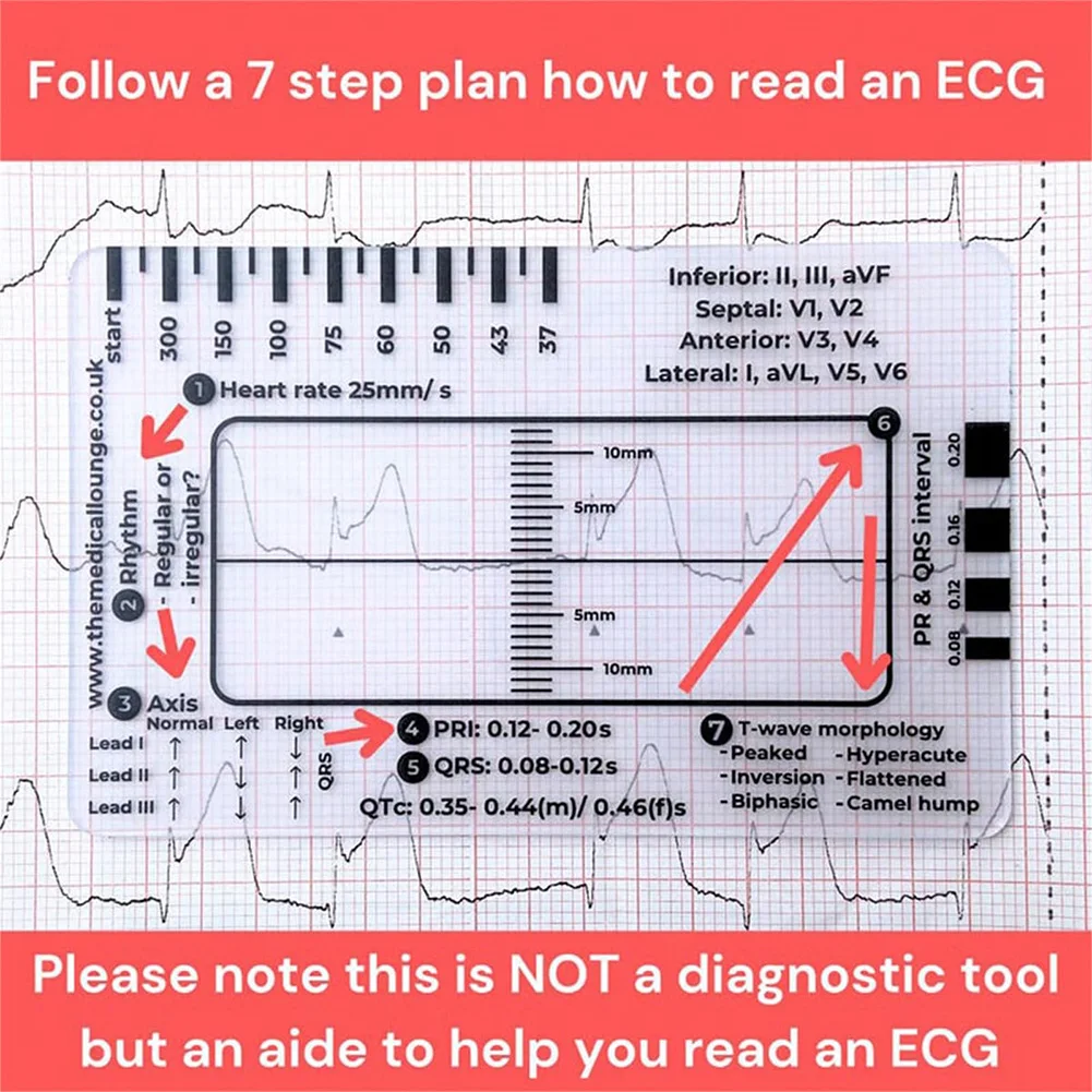 Ecg 7-step Ruler Ecg/ekg 7-step Ruler Card Portable Pocket Ecg Ekg Caliper With Protective Sheath A 7 Step Plan Evaluation Tool