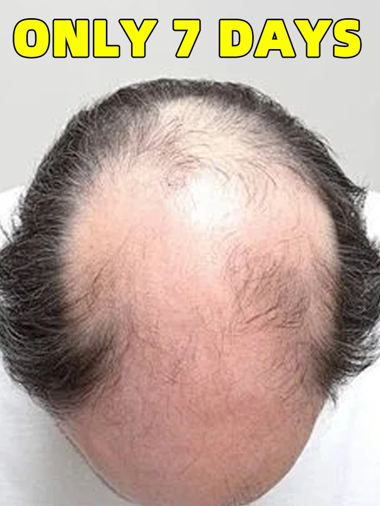 

Бесплатная доставка, аппликатор для головы, мини-массажер для головы, роликовая шариковая щетка для роста волос, жидкий аппликатор, массажная расческа, комбинация