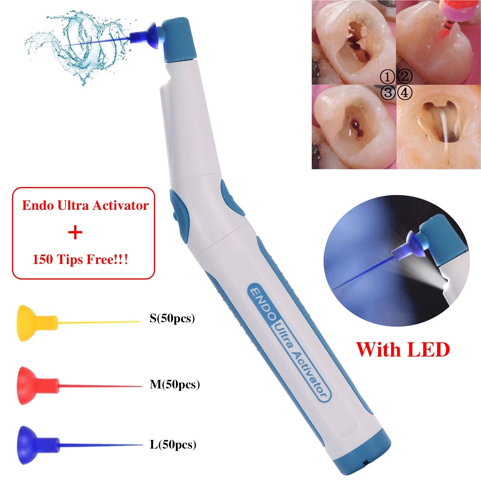

Dental Endo Ultra Activator Ultrasonic Irrigator Root Canal Scaling Handpiece Blue Color